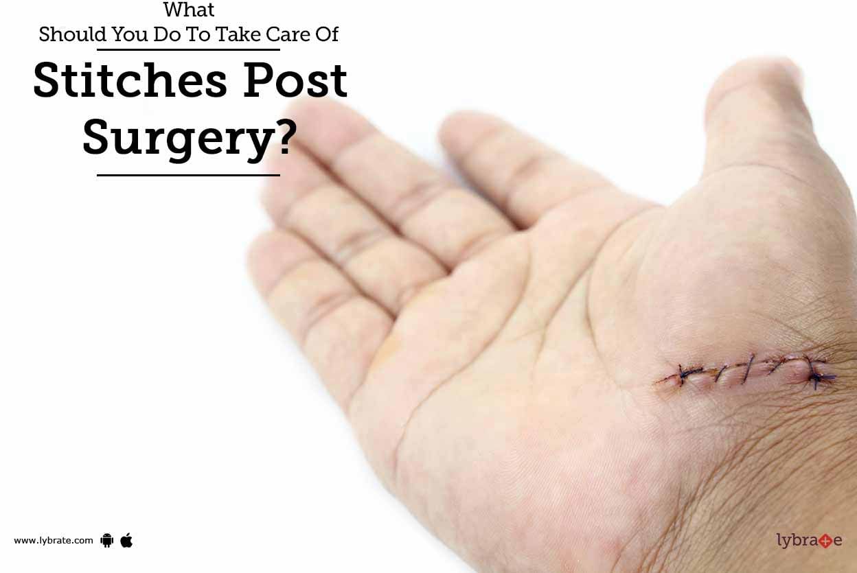 What Should You Do To Take Care Of Stitches Post Surgery?