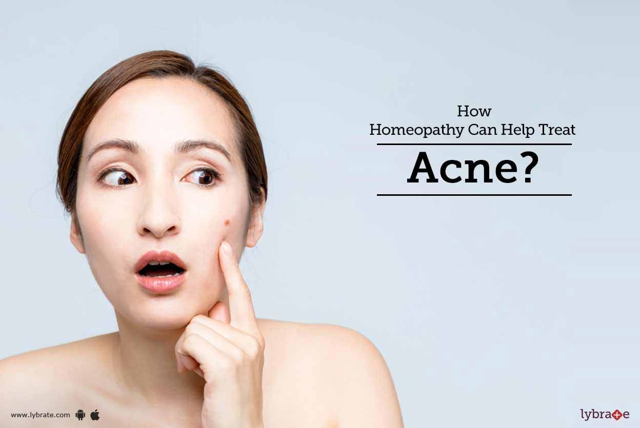 How Homeopathy Can Help Treat Acne?