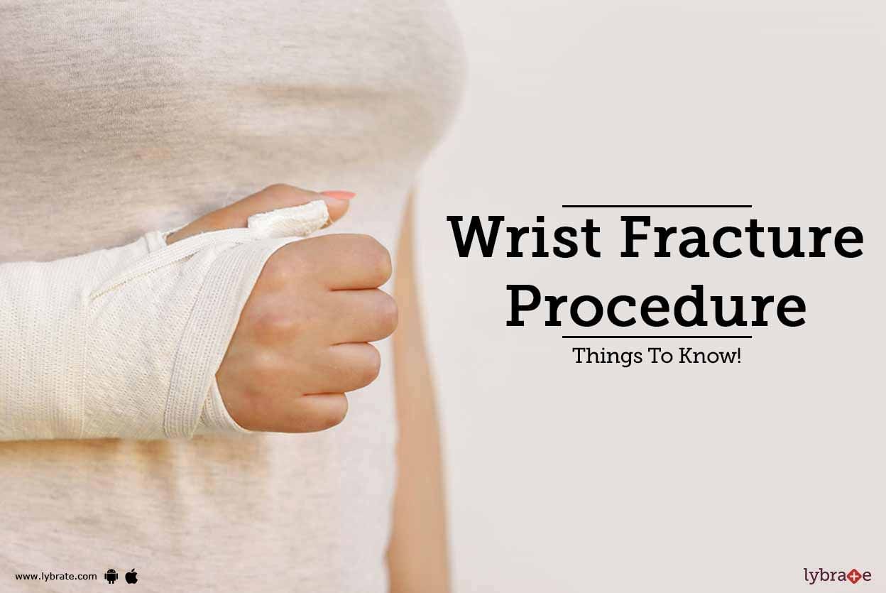 Wrist Fracture Procedure - Things To Know!