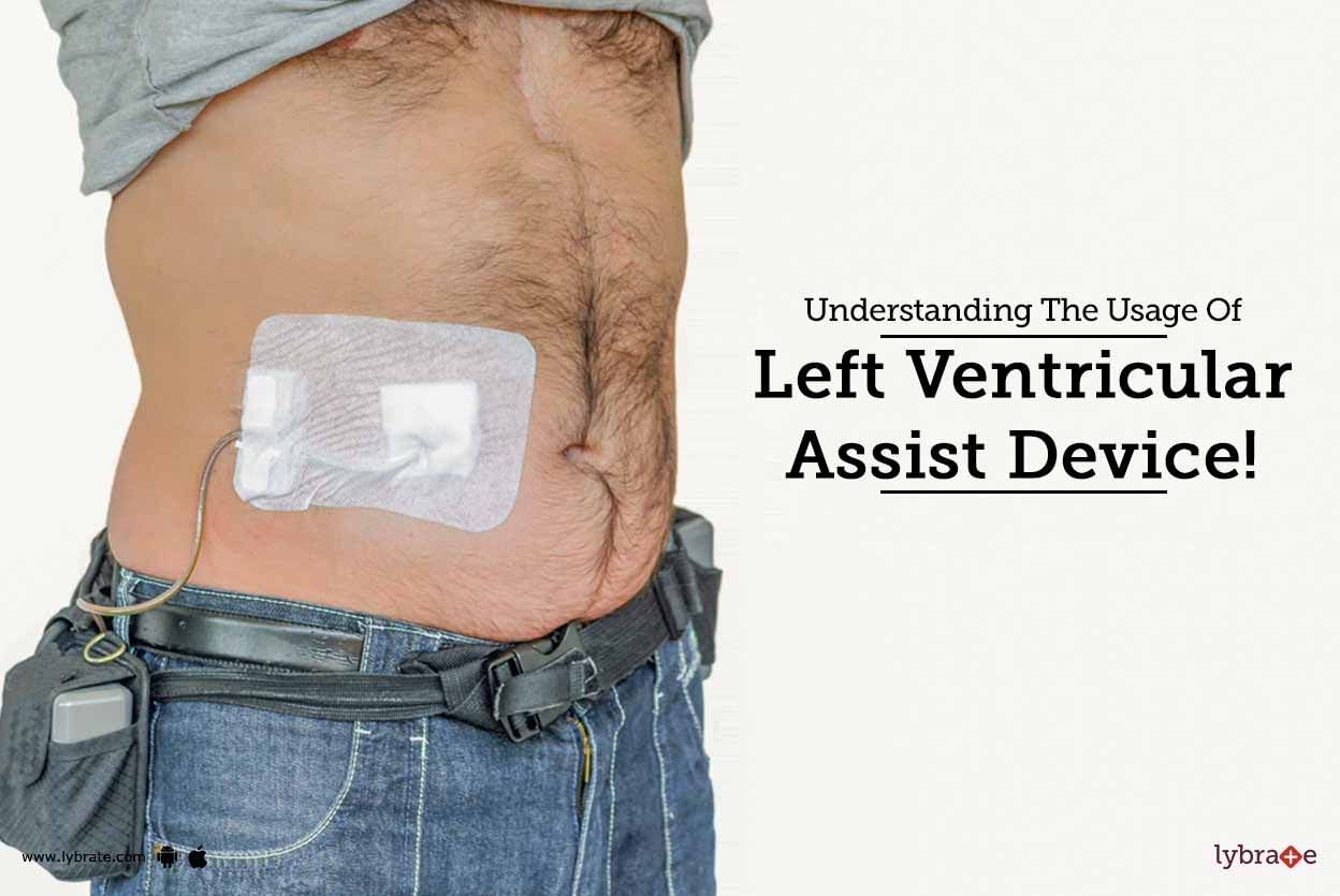 Understanding The Usage Of Left Ventricular Assist Device!