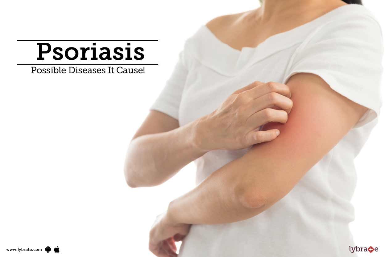 Psoriasis - Possible Diseases It Cause!