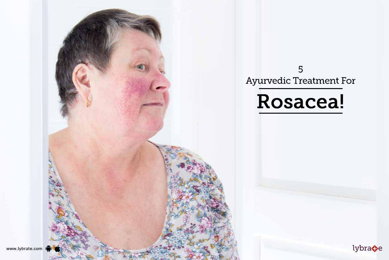 5 Ayurvedic Treatment For Rosacea!
