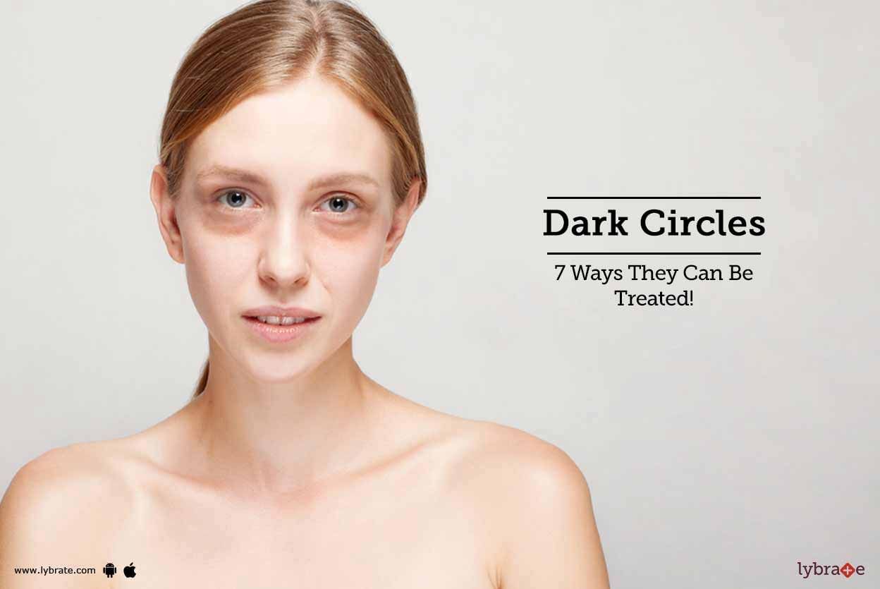 Dark Circles - 7 Ways They Can Be Treated!