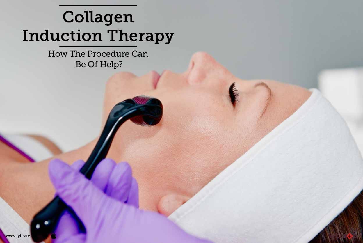 Collagen Induction Therapy - How The Procedure Can Be Of Help?