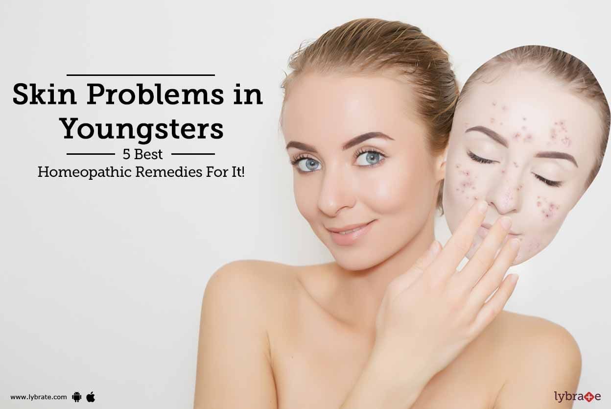 Skin Problems in Youngsters - 5 Best Homeopathic Remedies For It!