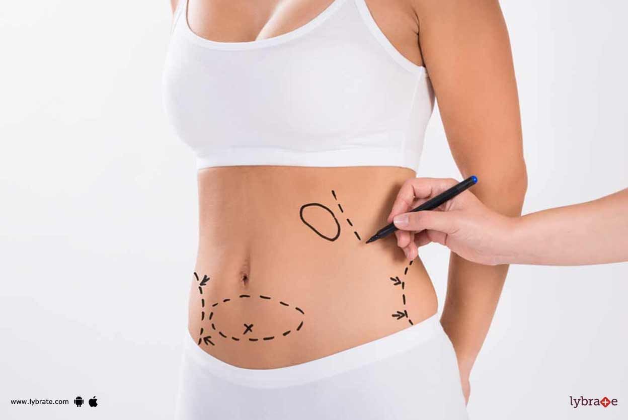 Body Contouring Cosmetic Surgery - How Secure Is It?