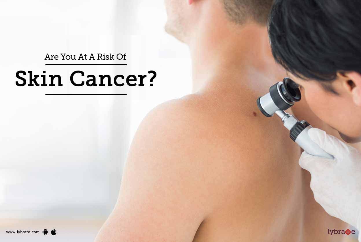 Are You At A Risk Of Skin Cancer?