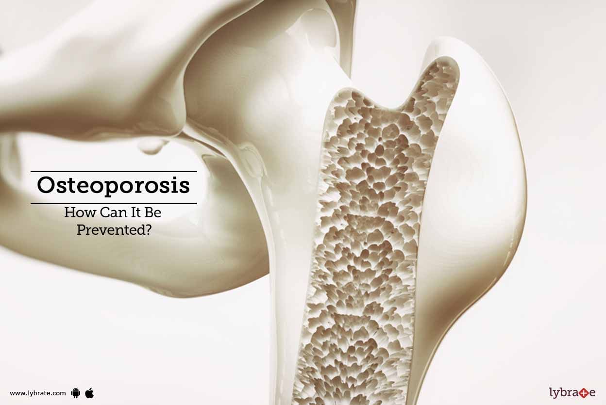 Osteoporosis - How Can It Be Prevented?
