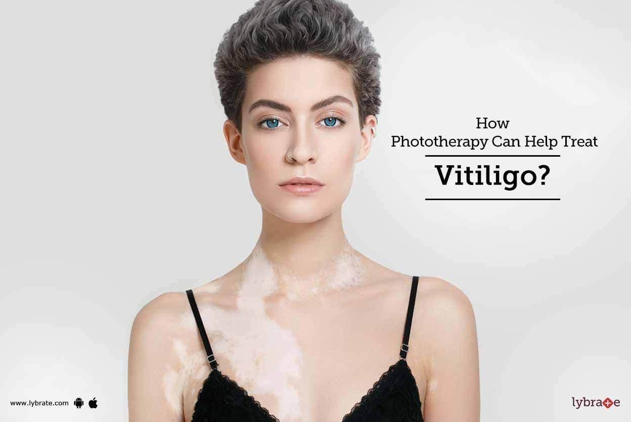 How Phototherapy Can Help Treat Vitiligo?