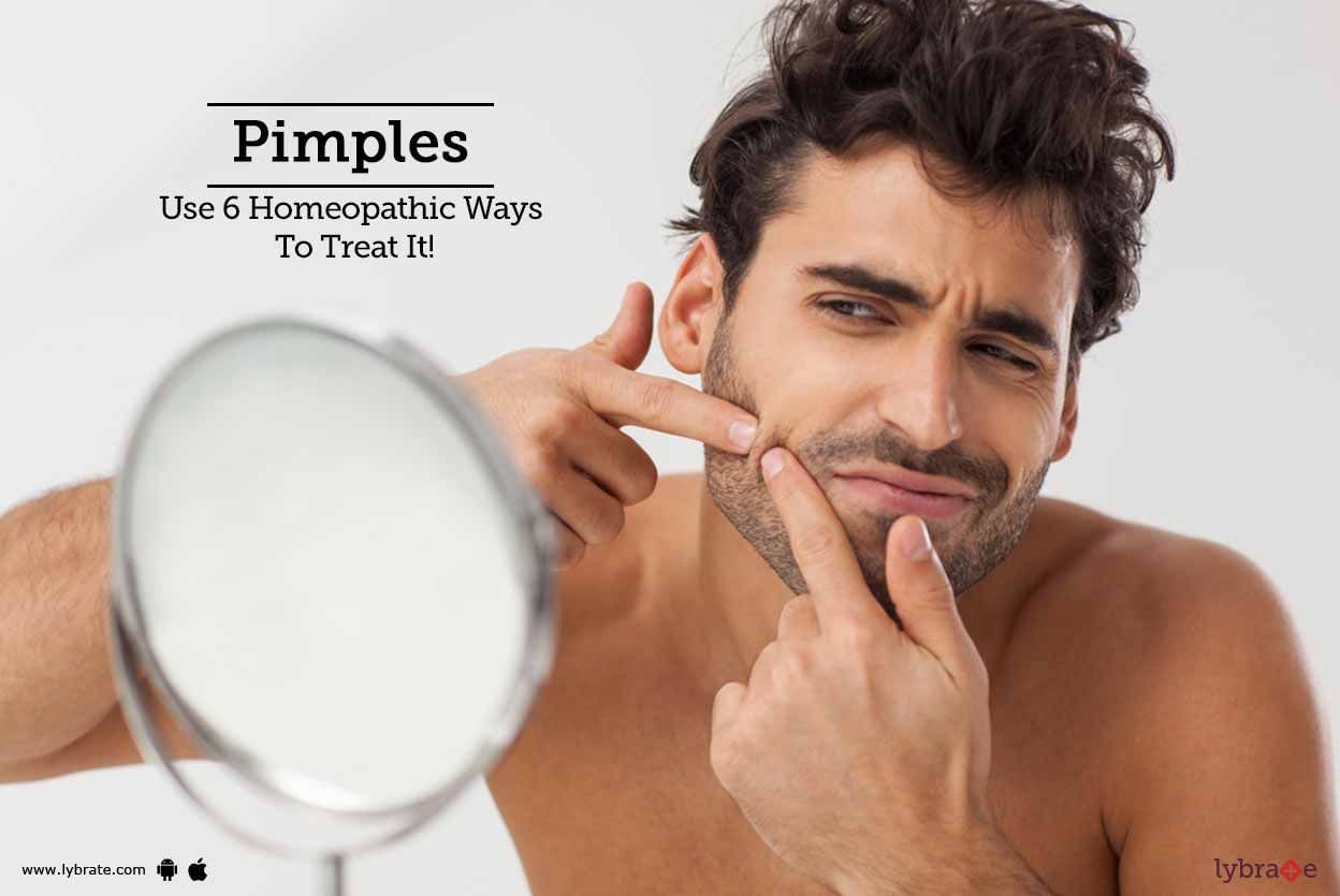Pimples - Use 6 Homeopathic Ways To Treat It!
