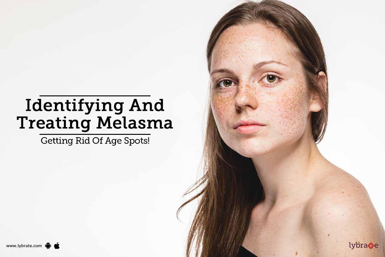 Identifying And Treating Melasma - Getting Rid Of Age Spots!