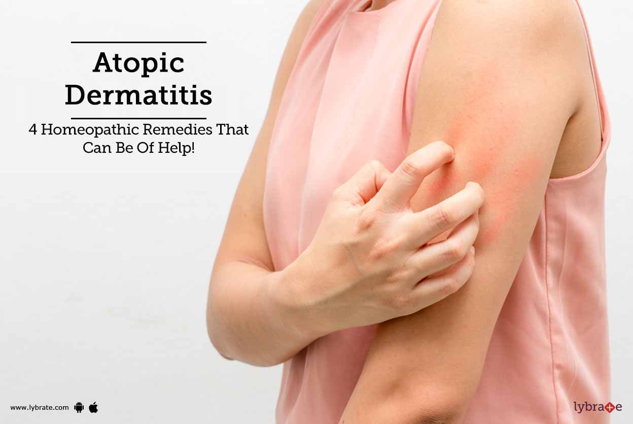 Atopic Dermatitis - 4 Homeopathic Remedies That Can Be Of Help!