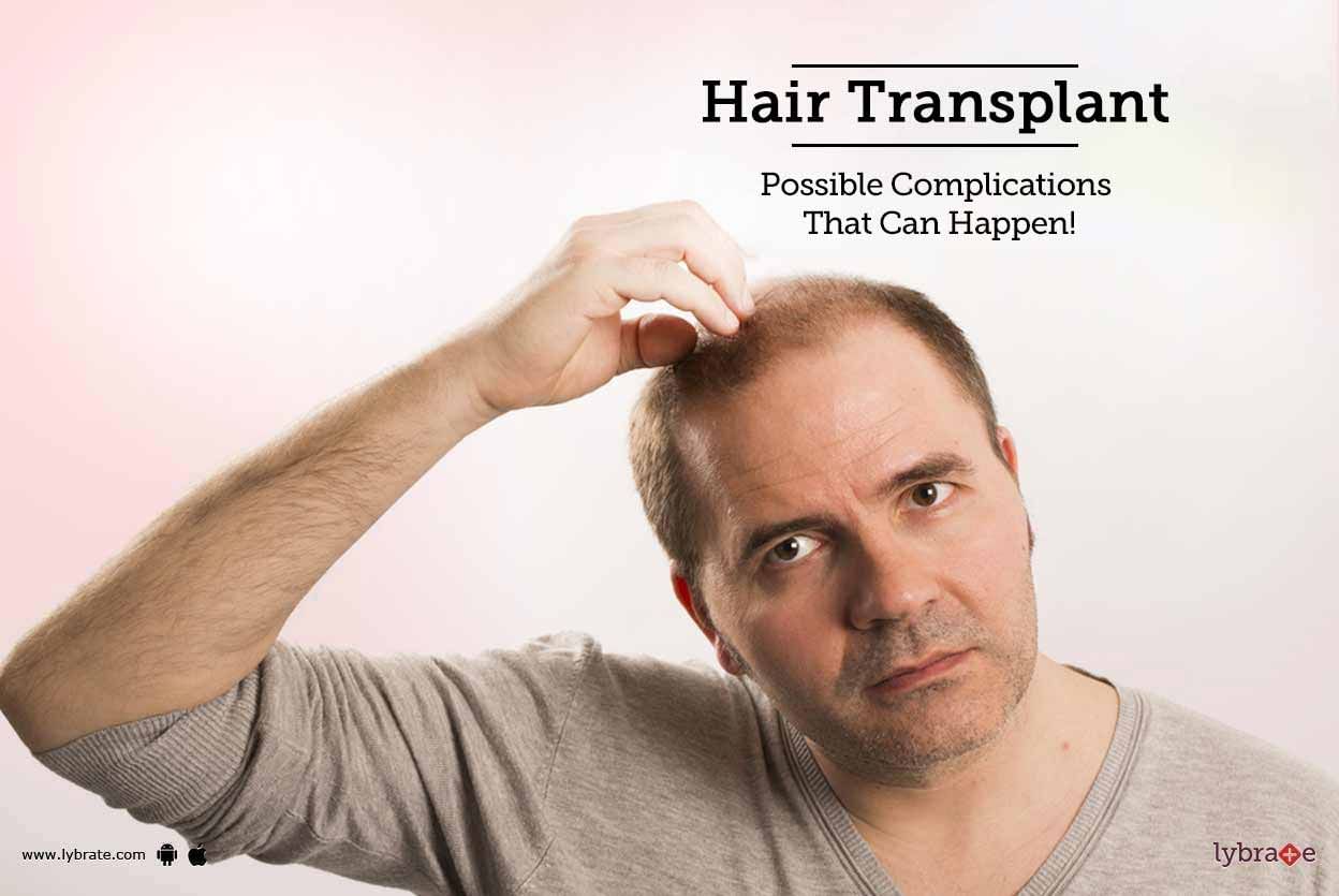 Hair Transplant - Possible Complications That Can Happen!