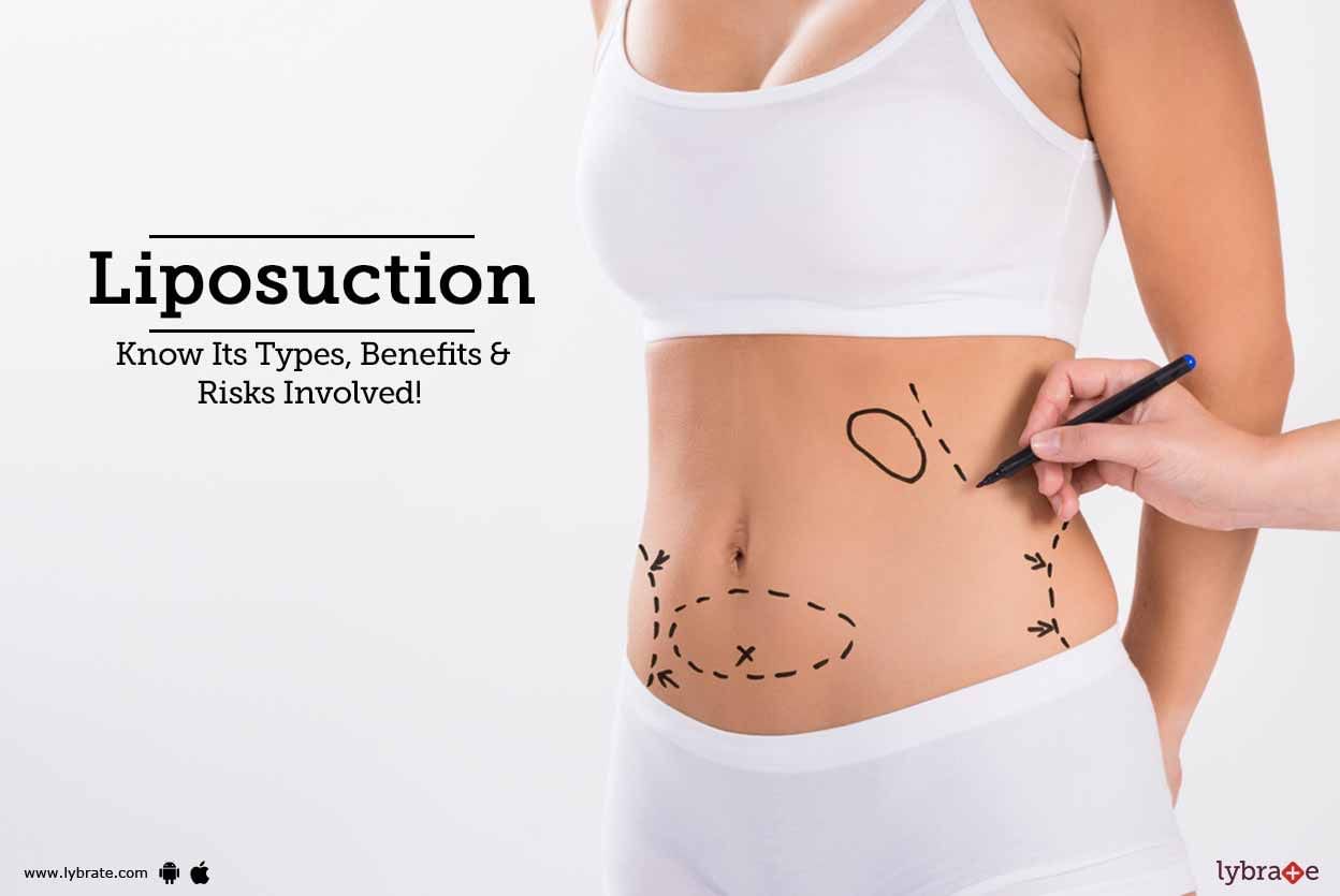 Liposuction - Know Its Types, Benefits & Risks Involved!
