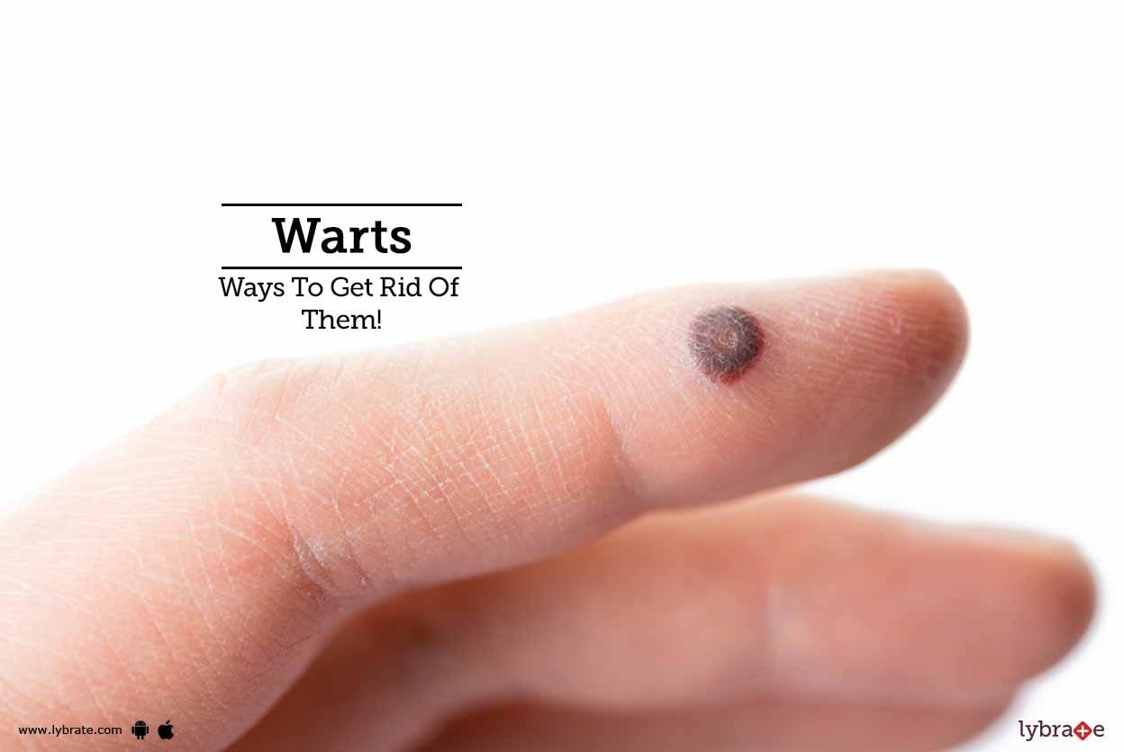 Warts - Ways To Get Rid Of Them!