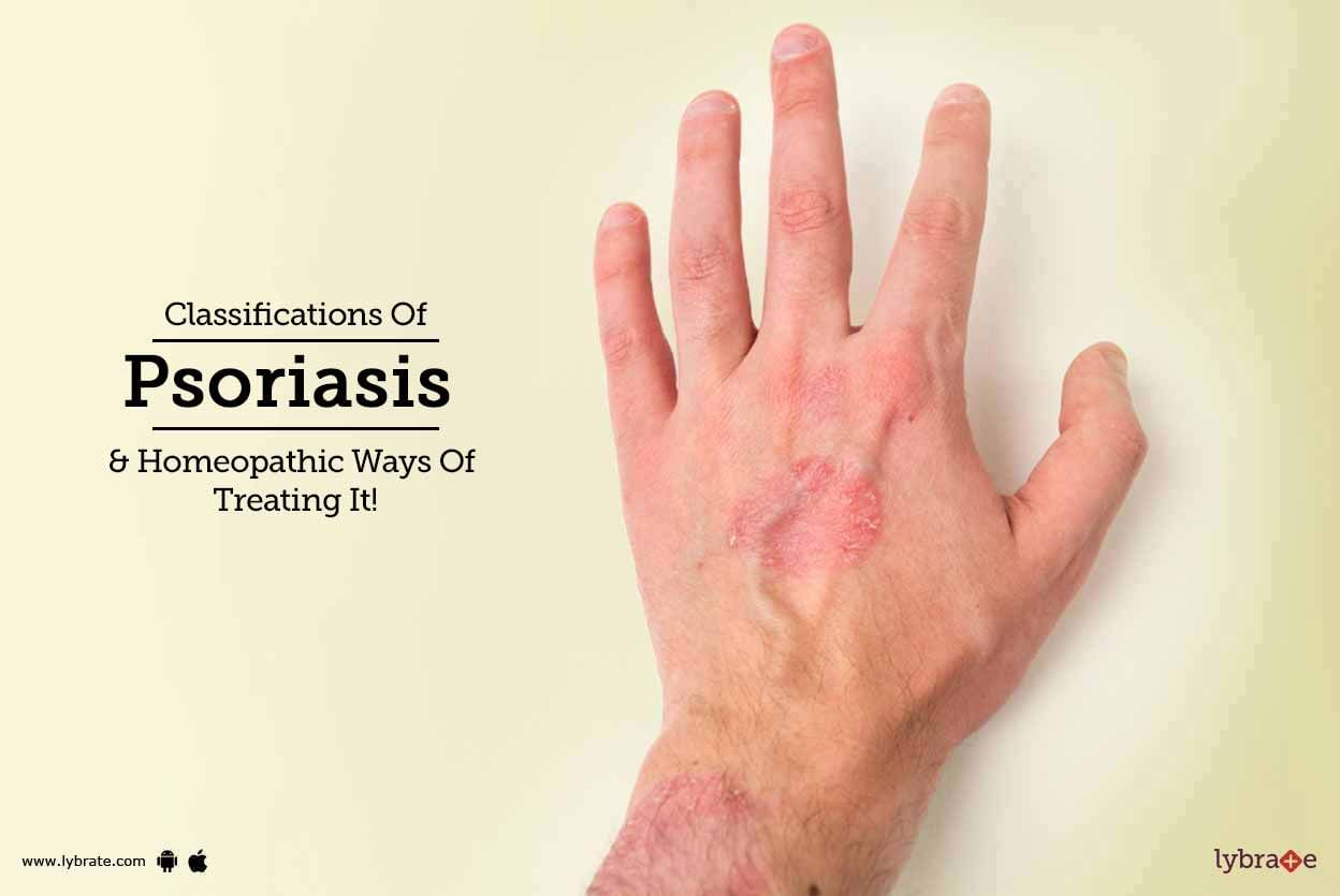 Classifications Of Psoriasis & Homeopathic Ways Of Treating It!