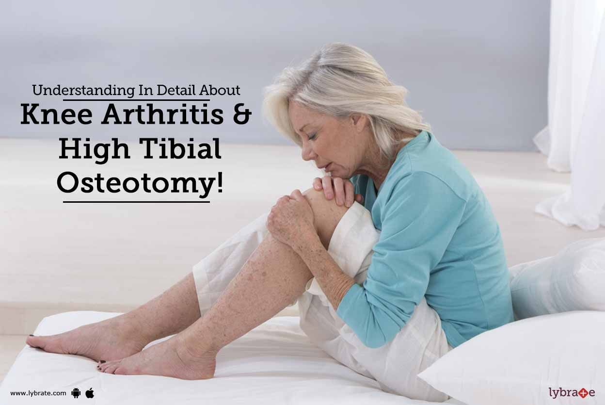 Understanding In Detail About Knee Arthritis & High Tibial Osteotomy!