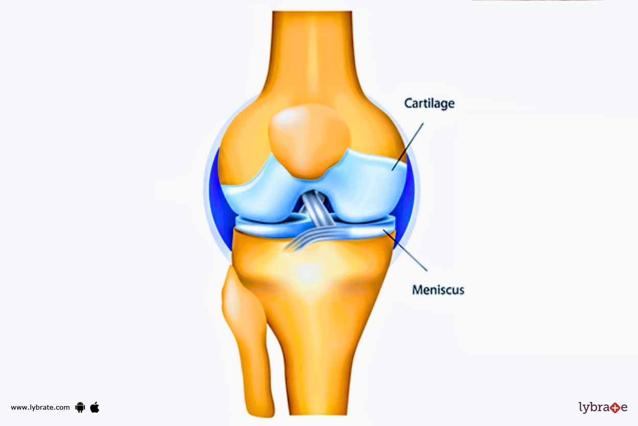 How To Deal With Damaged Cartilage?