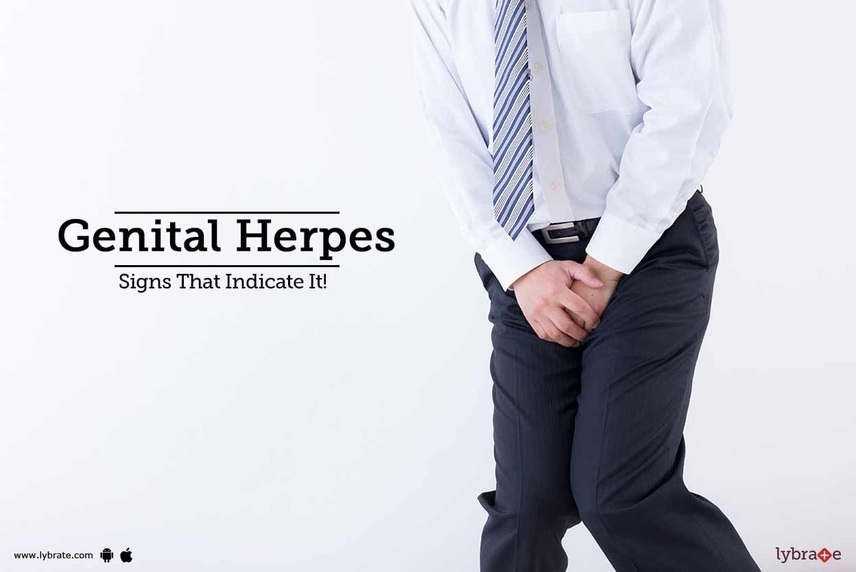 Genital Herpes - Signs That Indicate It!