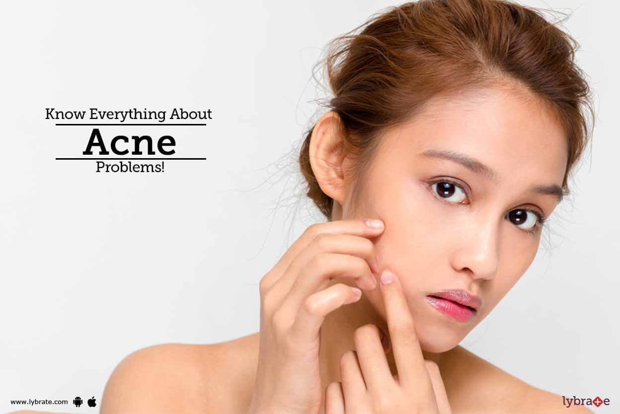 Know Everything About Acne Problems!