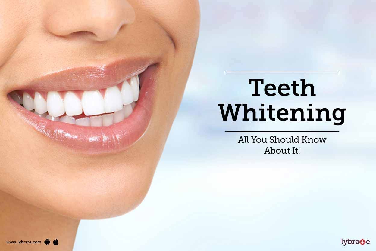Teeth Whitening - All You Should Know About It!