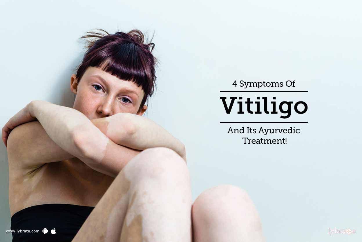 4 Symptoms Of Vitiligo And Its Ayurvedic Treatment!