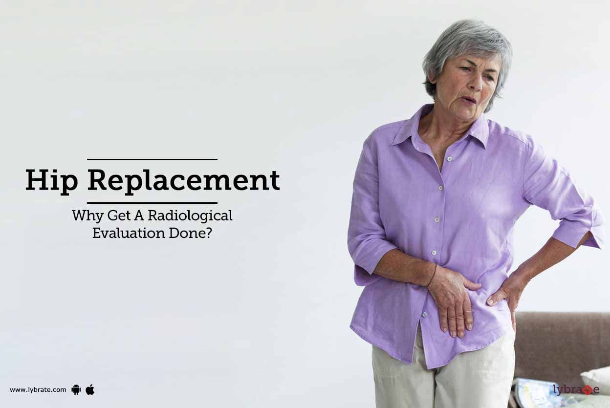 Hip Replacement - Why Get A Radiological Evaluation Done?
