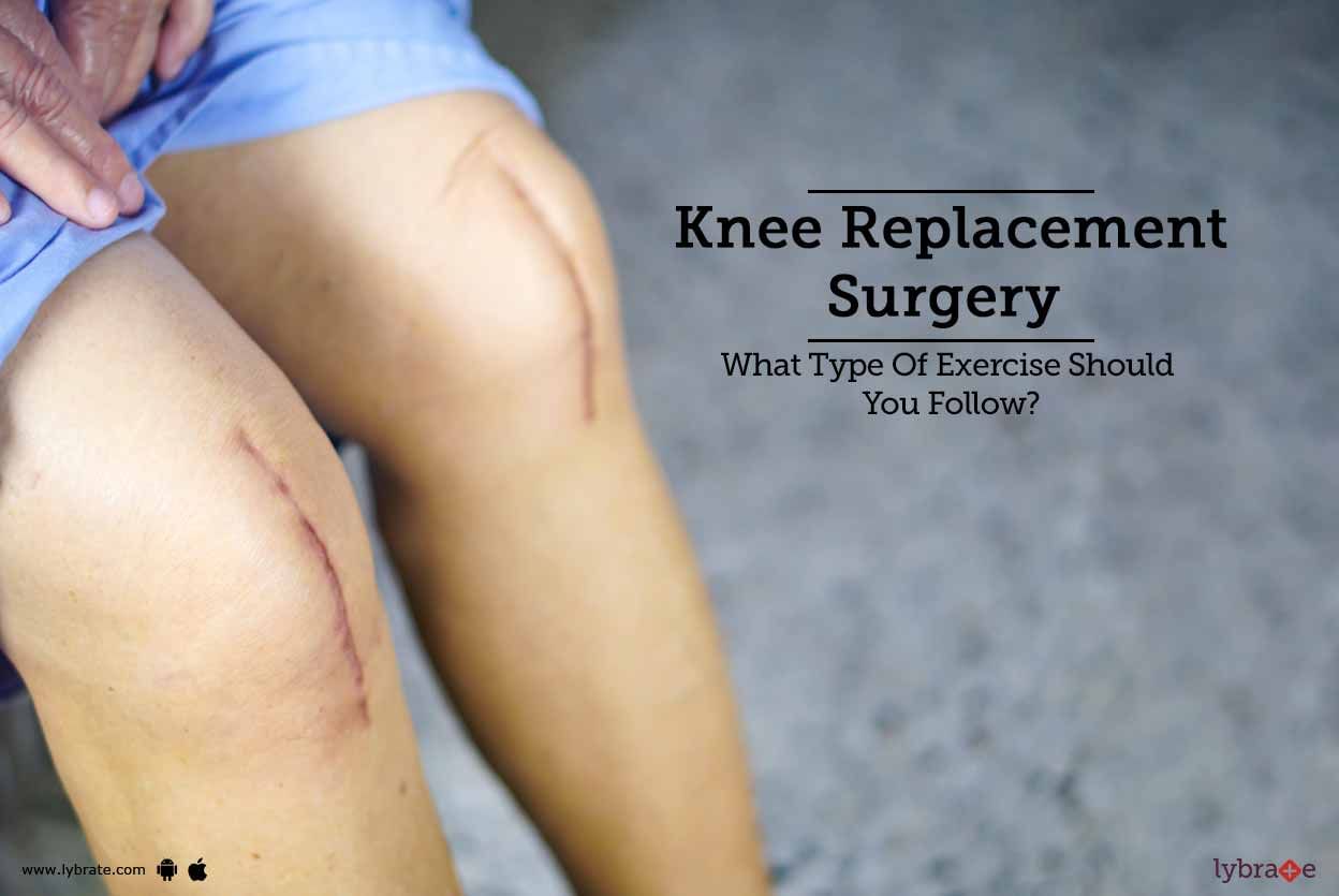 Knee Replacement Surgery - What Type Of Exercise Should You Follow?