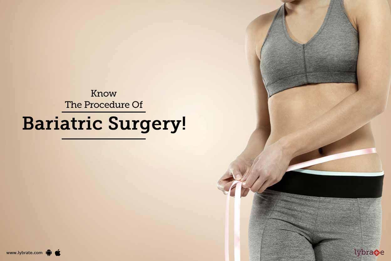 Know The Procedure Of Bariatric Surgery!