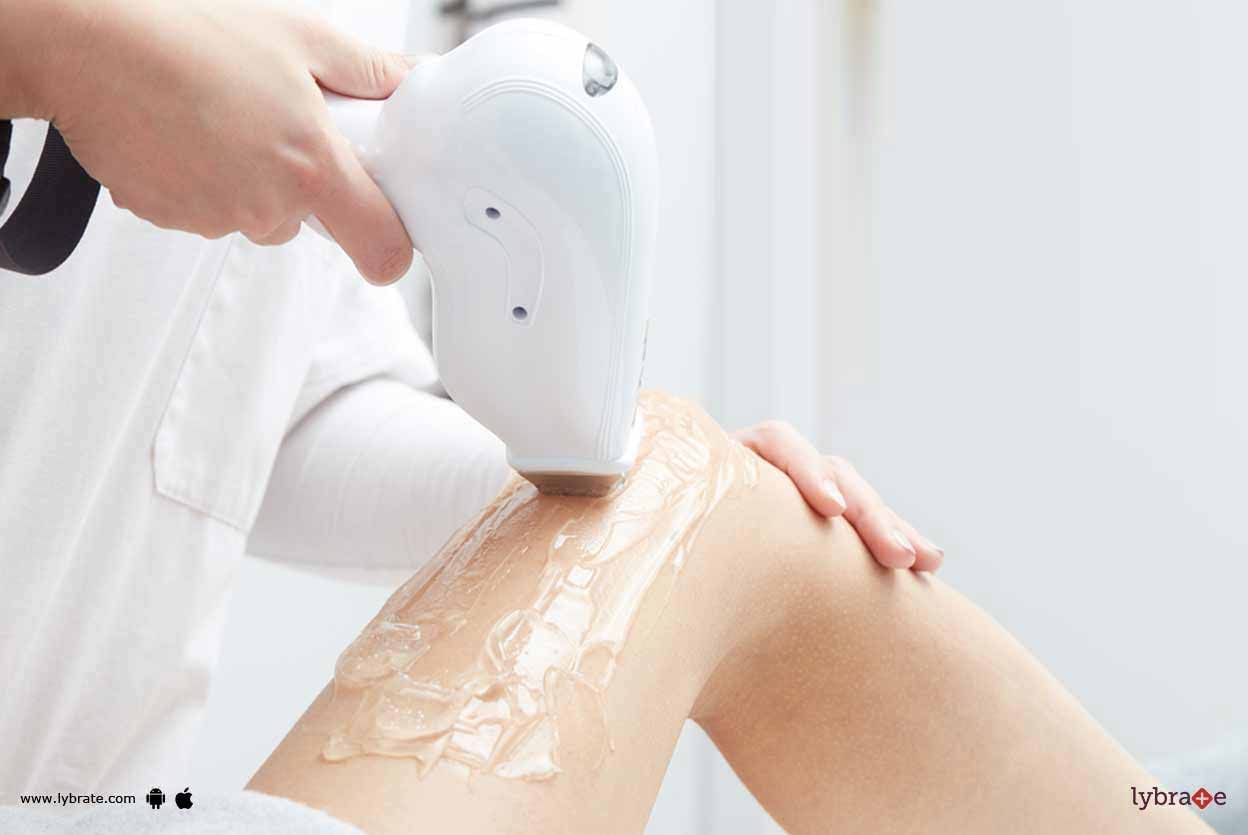 Laser Hair Removal - What To Expect From Treatment?