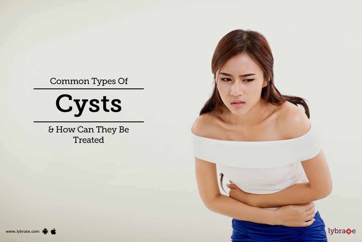 Common Types Of Cysts & How Can They Be Treated
