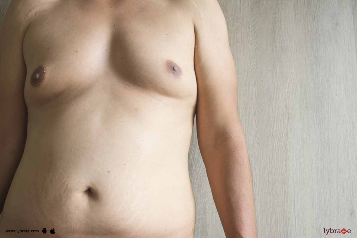 Male Breast - What Causes It?