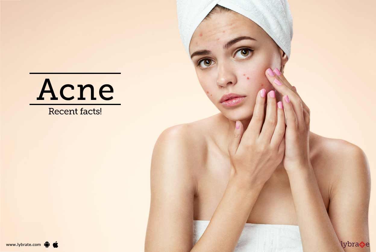 Acne - Recent facts!