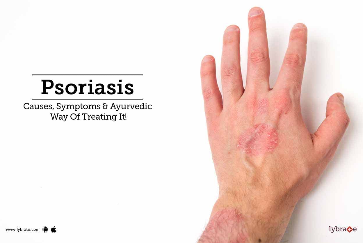 Psoriasis - Causes, Symptoms & Ayurvedic Way Of Treating It!