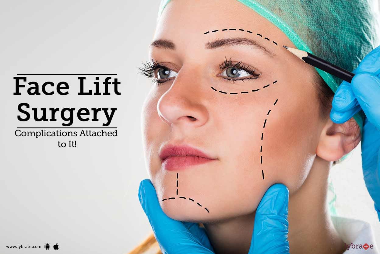 Face Lift Surgery - Complications Attached to It!