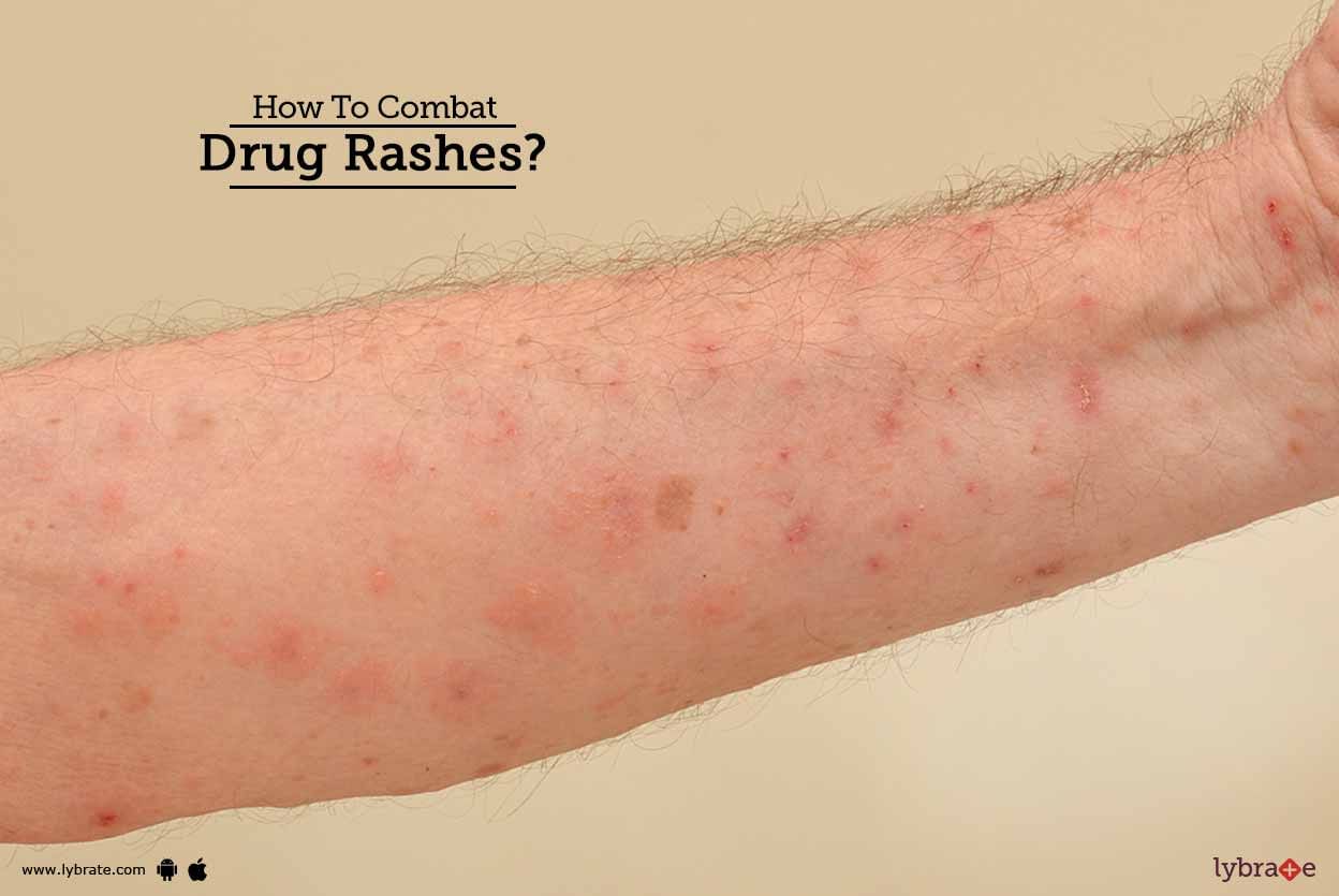How To Combat Drug Rashes?