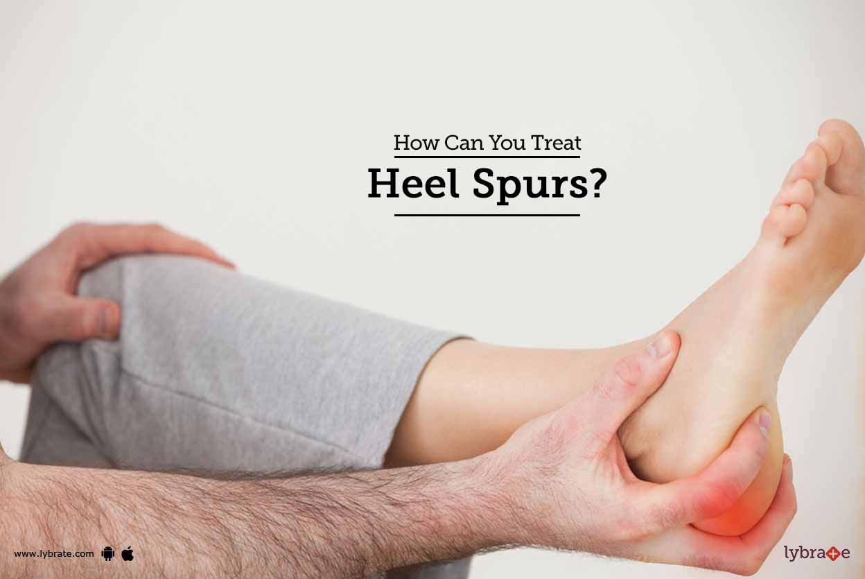 How Can You Treat Heel Spurs?