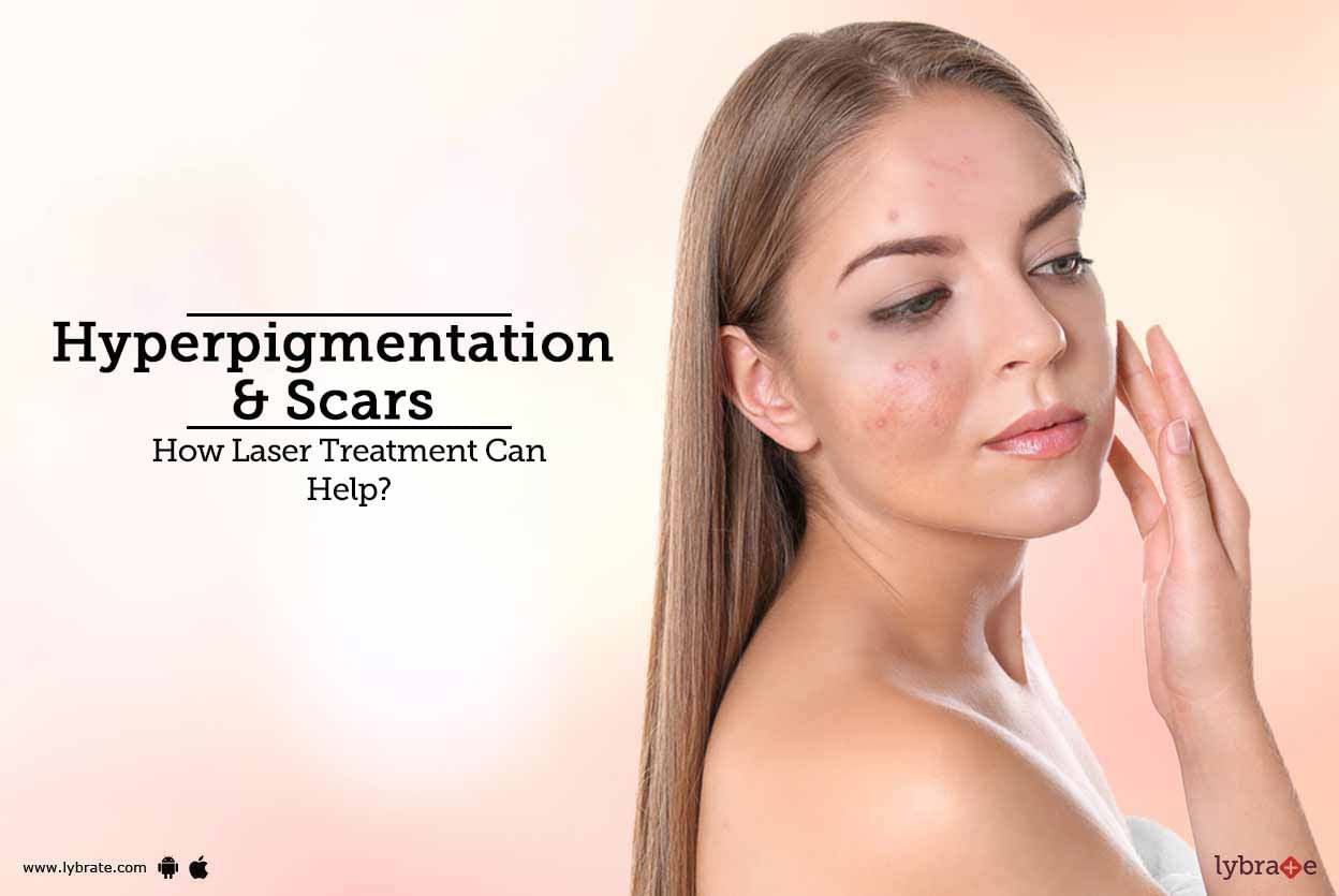 Hyperpigmentation & Scars - How Laser Treatment Can Help?