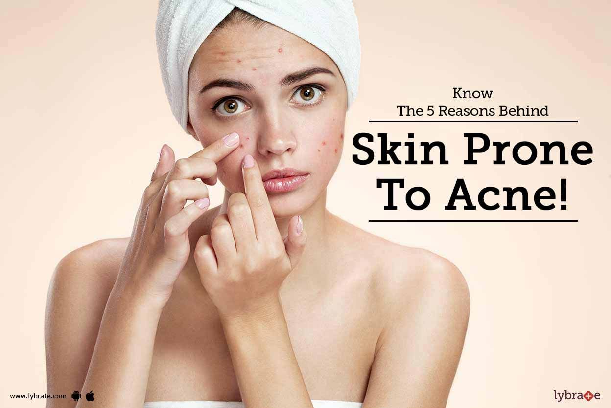 Know The 5 Reasons Behind Skin Prone To Acne!