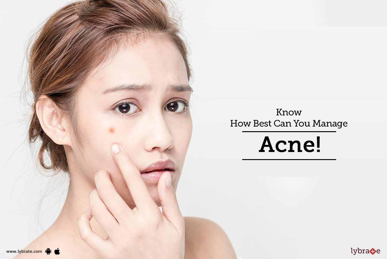 Know How Best Can You Manage Acne!