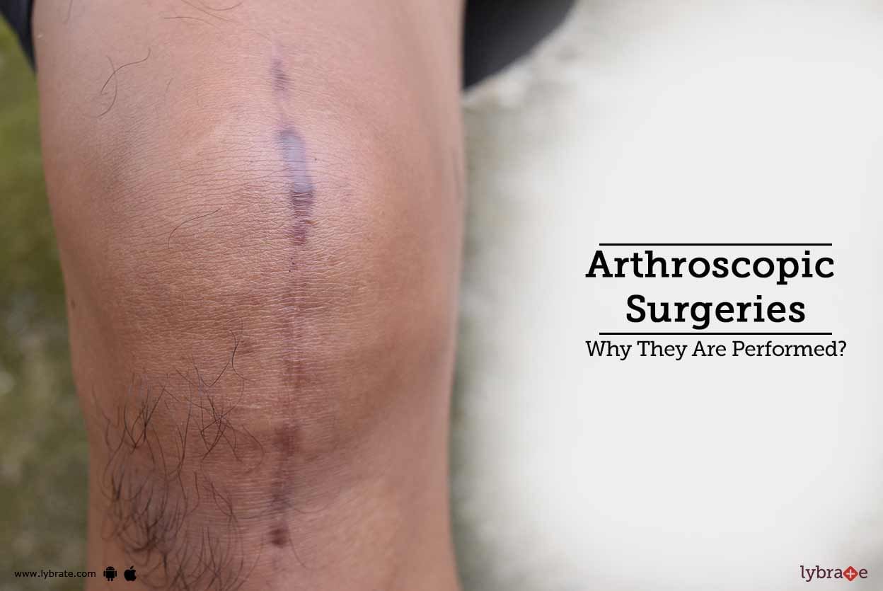 Arthroscopic Surgeries - Why They Are Performed?