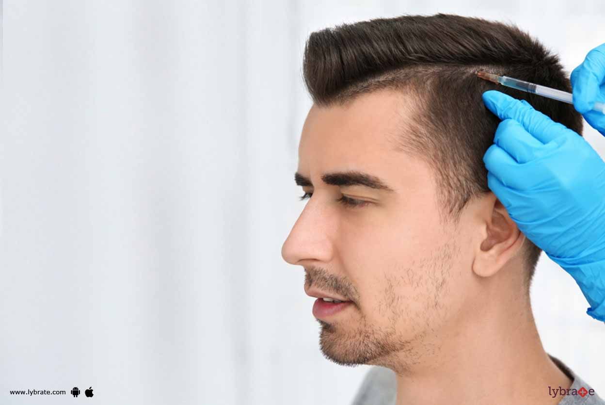 Hair Transplant Surgery - Reasons Why You Should Go For It!