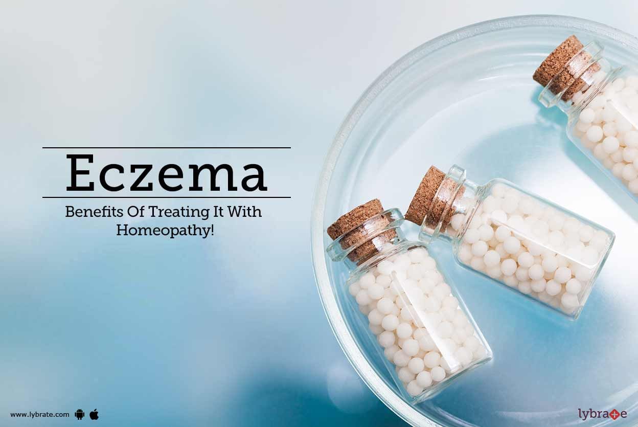 Eczema - Benefits Of Treating It With Homeopathy!