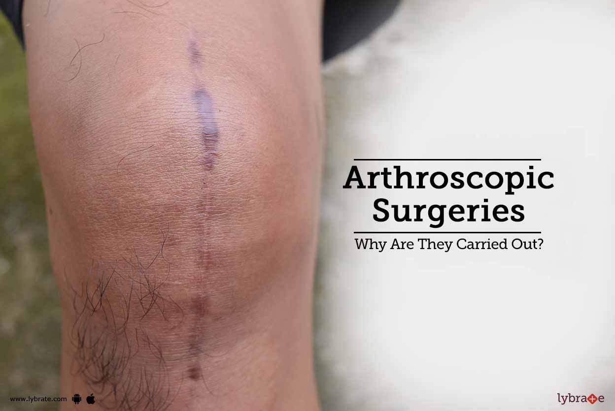 Arthroscopic Surgeries - Why Are They Carried Out?
