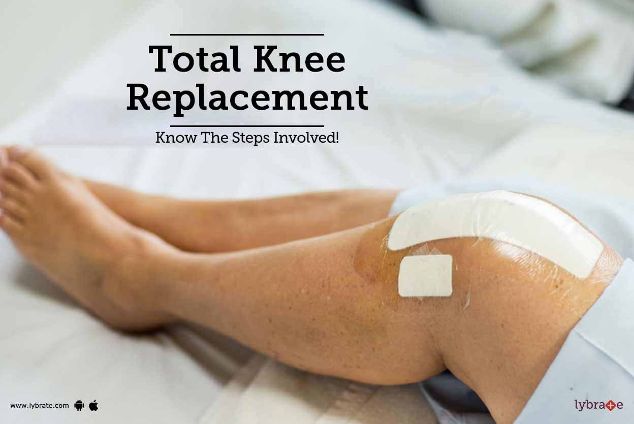 Total Knee Replacement - Know The Steps Involved!