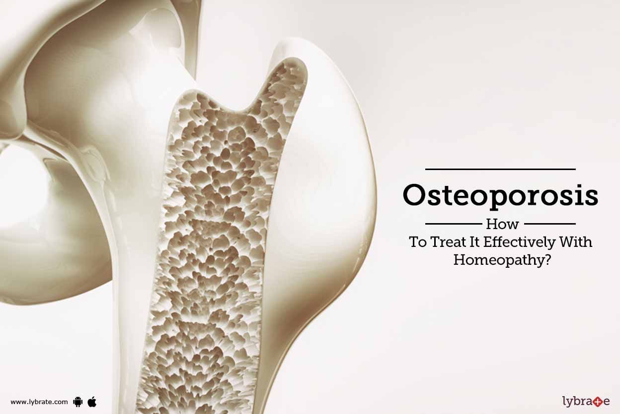 Osteoporosis - How To Treat It Effectively With Homeopathy?