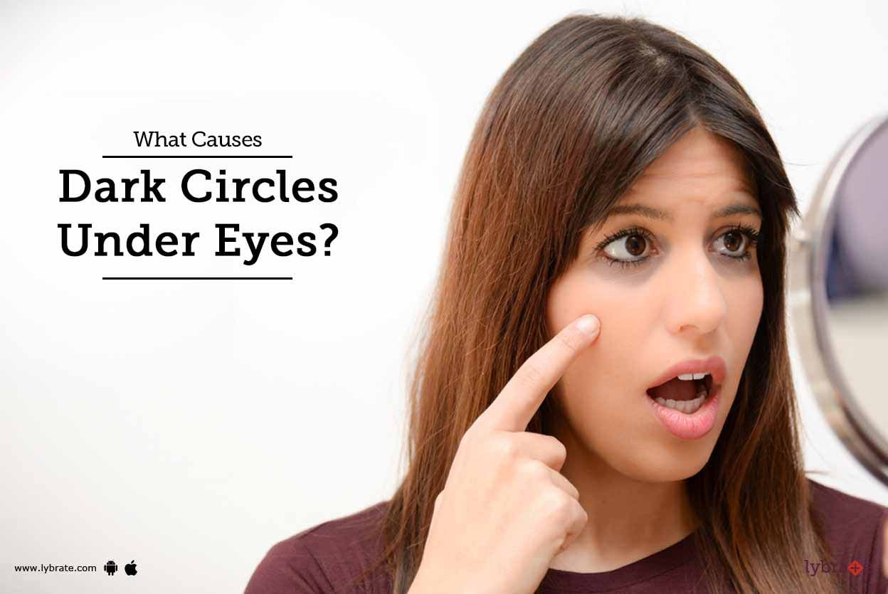 What Causes Dark Circles Under Eyes?