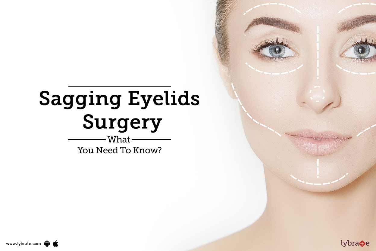 Sagging Eyelids Surgery: What You Need To Know?