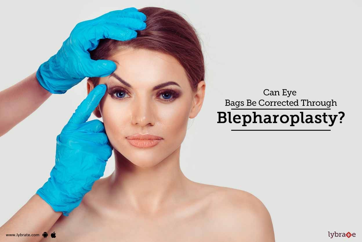 Can Eye Bags Be Corrected Through Blepharoplasty?