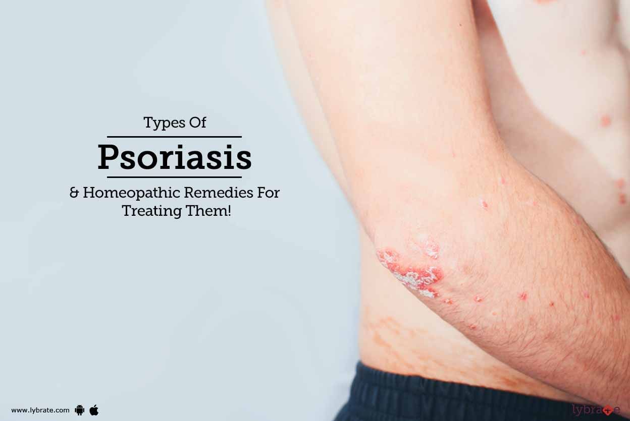 Types Of Psoriasis & Homeopathic Remedies For Treating Them!